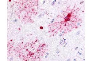 Immunohistochemical (Formalin/PFA-fixed paraffin-embedded sections) staining in human brain with GPR37 polyclonal antibody . (GPR37 anticorps)