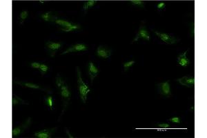 Immunofluorescence of monoclonal antibody to HDGF on HeLa cell.