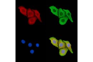 ABIN7095319 and ABIN7099376 staining Hela cells by IF/ICC. (P4HA3 anticorps)