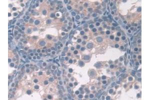 Detection of ASPN in Mouse Testis Tissue using Polyclonal Antibody to Asporin (ASPN) (Asporin anticorps  (AA 16-373))