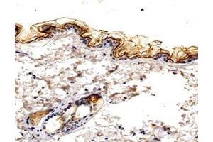 Immunohistochemistry analysis of paraffin-embedded mouse skin using,KLK7 (ABIN7074396) at dilution of 1: 1600