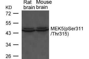 Western blot analysis of extracts from Rat and Mouse brain tissue using MEK5(phospho-Ser311/ Thr315) Antibody. (MAP2K5 anticorps  (pSer311, pThr315))