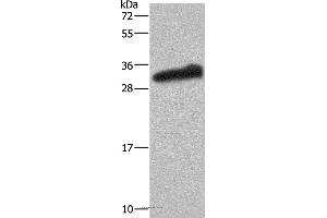 Western blot analysis of Human testis tissue, using GSTA3 Polyclonal Antibody at dilution of 1:250 (GSTA3 anticorps)