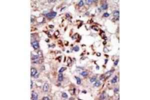 Image no. 2 for anti-Chromobox Homolog 8 (CBX8) (C-Term) antibody (ABIN357753) (CBX8 anticorps  (C-Term))
