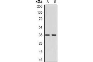 Western blot analysis of CTGF expression in Hela (A), HepG2 (B) whole cell lysates. (CTGF anticorps)