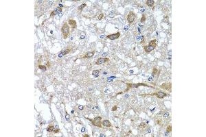 Immunohistochemistry of paraffin-embedded rat brain using OSGEPL1 antibody. (OSGEPL1 anticorps  (AA 1-270))