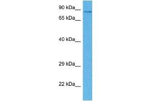 Host:  Rabbit  Target Name:  CPEB4  Sample Tissue:  Human DLD1 Whole Cell  Antibody Dilution:  1ug/ml (CPEB4 anticorps  (N-Term))