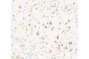 Immunohistochemistry analysis of paraffin-embedded mouse brain using,KCNF1 (ABIN7075155) at dilution of 1: 2400 (KCNF1 anticorps)