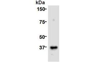 Western Blotting (WB) image for anti-Cell Division Cycle Associated 8 (CDCA8) (AA 1-280), (N-Term) antibody (ABIN1449290) (CDCA8 anticorps  (N-Term))