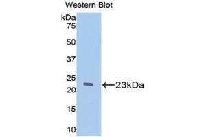 Western blot analysis of the recombinant protein. (Retinol Binding Protein 5 anticorps  (AA 19-201))