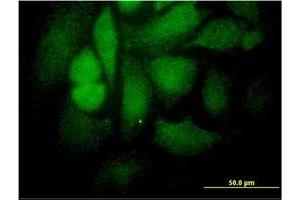 Immunofluorescence of monoclonal antibody to STAT4 on HeLa cell.