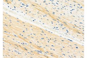 ABIN6265404 and ABIN6273174 at 1/100 staining Rat heart tissue by IHC-P. (Syntaxin 16 anticorps  (N-Term))