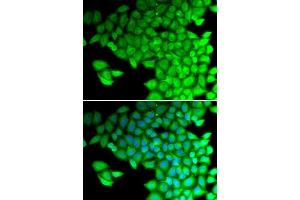 Immunofluorescence analysis of HeLa cells using MYL2 antibody. (MYL2 anticorps  (AA 1-166))