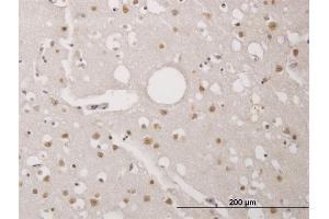 Immunoperoxidase of monoclonal antibody to TP53RK on formalin-fixed paraffin-embedded human cerebral cortex. (TP53RK anticorps  (AA 154-253))