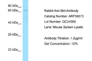 Western Blotting (WB) image for anti-SKI-Like Oncogene (SKIL) (C-Term) antibody (ABIN2787538)