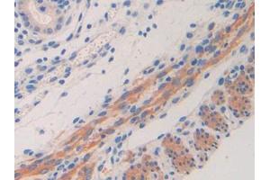 Used in DAB staining on fromalin fixed paraffin- embedded kidney tissue (IL11RA anticorps  (AA 59-217))