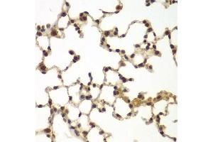 Immunohistochemistry of paraffin-embedded mouse lung using SULT2B1 antibody.