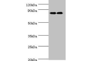 Western blot All lanes: ANAPC5 antibody at 2 μg/mL Lane 1: 293T whole cell lysate Lane 2: NIH/3T3 whole cell lysate Secondary Goat polyclonal to rabbit IgG at 1/10000 dilution Predicted band size: 86, 26, 73 kDa Observed band size: 86 kDa (ANAPC5 anticorps  (AA 1-250))