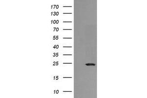 Image no. 2 for anti-RAB21, Member RAS Oncogene Family (RAB21) antibody (ABIN1500544) (RAB21 anticorps)