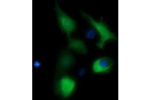 Image no. 3 for anti-butyrobetaine (Gamma), 2-Oxoglutarate Dioxygenase (Gamma-butyrobetaine Hydroxylase) 1 (BBOX1) antibody (ABIN1496815)