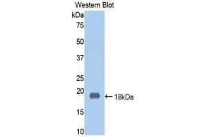 Western blot analysis of the recombinant protein. (Prothrombin anticorps  (AA 201-324))
