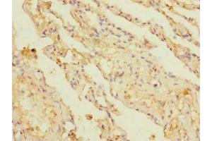 Immunohistochemistry of paraffin-embedded human lung tissue using ABIN7145856 at dilution of 1:100 (KCTD6 anticorps  (AA 1-237))