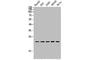Western blot analysis of HepG2 823-AV 293T AD293 Hela lysis using PGLYRP1 antibody. (PGLYRP1 anticorps  (Internal Region))