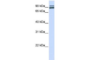 WB Suggested Anti-PCSK6 Antibody Titration: 0. (PCSK6 anticorps  (N-Term))