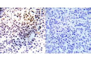 Immunohistochemical analysis of paraffin- embedded human malignant lymphoma tissue using Histone H3. (Histone H3.1 anticorps)