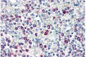 Human Spleen (formalin-fixed, paraffin-embedded) stained with HSPD1 antibody ABIN462102 at 10 ug/ml followed by biotinylated anti-mouse IgG secondary antibody ABIN481714, alkaline phosphatase-streptavidin and chromogen.