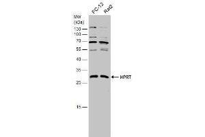 WB Image Various whole cell extracts (30 μg) were separated by 12% SDS-PAGE, and the membrane was blotted with HPRT antibody , diluted at 1:1000. (HPRT1 anticorps)