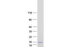 Validation with Western Blot