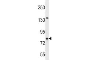 CPT1B antibody western blot analysis in SK-BR-3 lysate