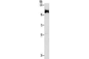 Western Blotting (WB) image for anti-Disabled Homolog 2, Mitogen-Responsive phosphoprotein (Drosophila) (DAB2) antibody (ABIN2429887) (DAB2 anticorps)