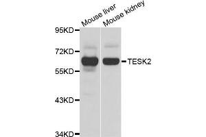Western blot analysis of extracts of various cell lines, using TESK2 antibody (ABIN5975294) at 1/1000 dilution. (TESK2 anticorps)