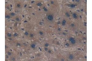 Detection of GCLM in Human Liver Tissue using Polyclonal Antibody to Glutamate Cysteine Ligase, Modifier Subunit (GCLM) (GCLM anticorps  (AA 40-251))