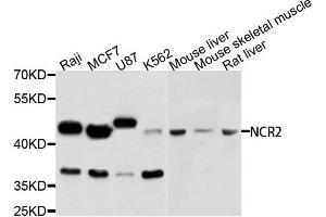Western blot analysis of extracts of various cells, using NCR2 antibody. (NKp44/NCR2 anticorps)