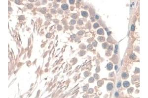 Detection of GAMT in Rat Testis Tissue using Polyclonal Antibody to Guanidinoacetate-N-Methyltransferase (GAMT)