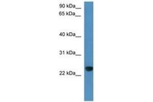 Image no. 1 for anti-Calcyphosine-Like (CAPSL) (C-Term) antibody (ABIN6746360) (CAPSL anticorps  (C-Term))