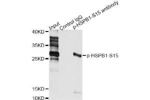 Immunoprecipitation analysis of 200 μg extracts of HeLa cells treated by EGF using 2.
