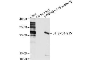 Immunoprecipitation analysis of 200 μg extracts of HeLa cells treated by EGF using 2. (HSP27 anticorps  (pSer15))