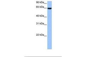 Image no. 1 for anti-Collagen, Type IV, alpha 3 (Goodpasture Antigen) Binding Protein (COL4A3BP) (AA 22-71) antibody (ABIN6738829)