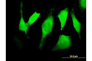 Immunofluorescence of purified MaxPab antibody to EGFR on HeLa cell. (EGFR anticorps  (AA 1-405))
