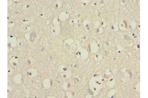 Immunohistochemistry of paraffin-embedded human brain tissue using ABIN7152155 at dilution of 1:100 (EIF3F anticorps  (AA 88-357))