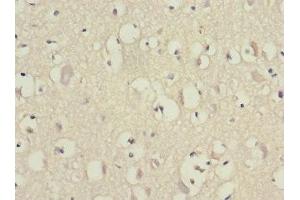 Immunohistochemistry of paraffin-embedded human brain tissue using ABIN7152155 at dilution of 1:100 (EIF3F anticorps  (AA 88-357))