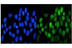 anti-Discoidin Domain Receptor tyrosine Kinase 1 (DDR1) (AA 341-909) antibody