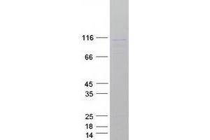 Validation with Western Blot