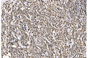 IHC analysis of WAPL/FOE using anti-WAPL/FOE antibody (ABIN7602663). (WAPAL anticorps  (AA 916-1190))