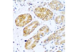 Immunohistochemistry of paraffin-embedded human stomach using NCAM1 antibody (ABIN5975670) at dilution of 1/100 (40x lens). (CD56 anticorps)