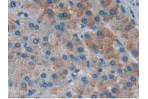 Detection of IkBd in Human Liver Tissue using Polyclonal Antibody to Inhibitory Subunit Of NF Kappa B Delta (IkBd) (IkBd anticorps  (AA 46-285))